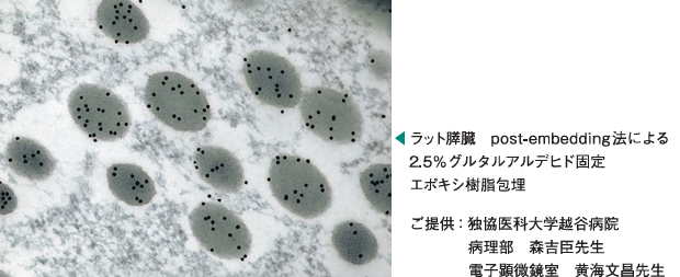 抗原激活剂免疫保护剂