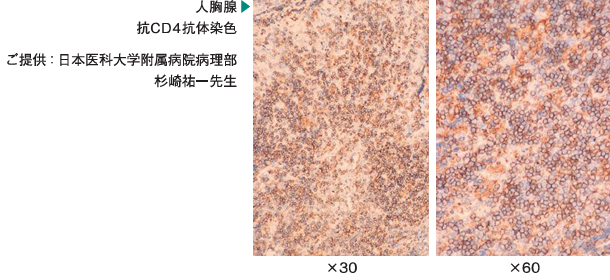 抗原激活剂免疫保护剂