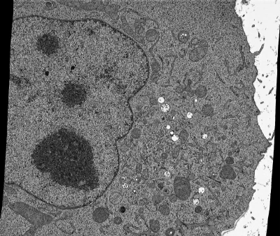 CLEM/vEM特化樹脂　R221®