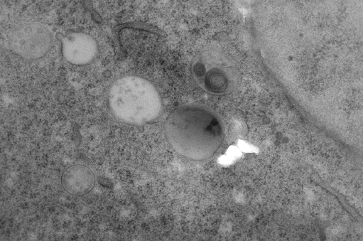 CLEM/vEM特化樹脂　R221®