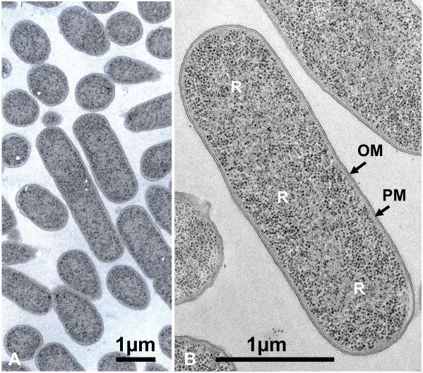 サンドイッチ凍結法用グリッド
