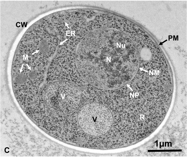 サンドイッチ凍結法用グリッド