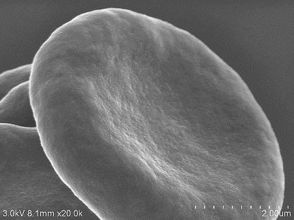 Reagents, stains, and other materials for SEM (Scanning Electron