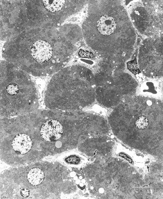 电子显微镜图谱大鼠正常结构 1 肝脏 肝脏