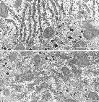 电子显微镜图谱大鼠正常结构 1 肝脏 肝脏