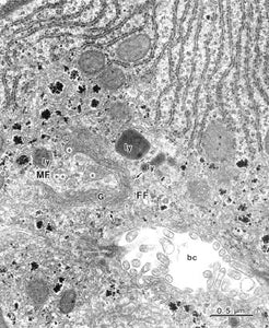 Electron Microscope Atlas Rat Normal Structure 1 Liver Liver