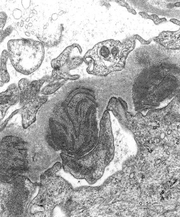 電子顕微鏡アトラス 腎生検 renal biopsy – Nisshin-EM