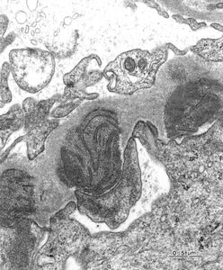 電子顕微鏡アトラス　腎生検　renal biopsy