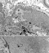 画像をギャラリービューアに読み込む, 電子顕微鏡アトラス　腎生検　renal biopsy
